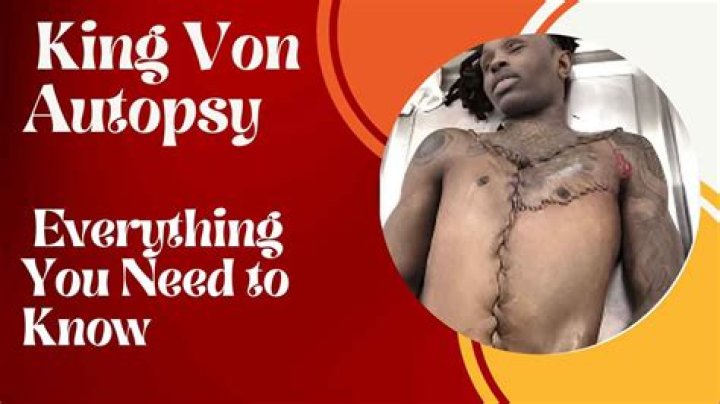 Unveiling The Truth: Pictures Of King Von Autopsy